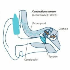 CROSSCALL Casque écouteur Conduction Osseuse X-VIBES - 1304069999572 -Bosch Soldes Magasin crosscall casque ecouteur conduction osseuse x vibes 1304069999572 4